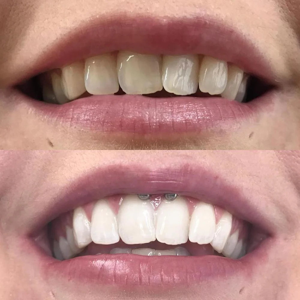 Instasmile™ - Dentifrice Violet Blanchissant