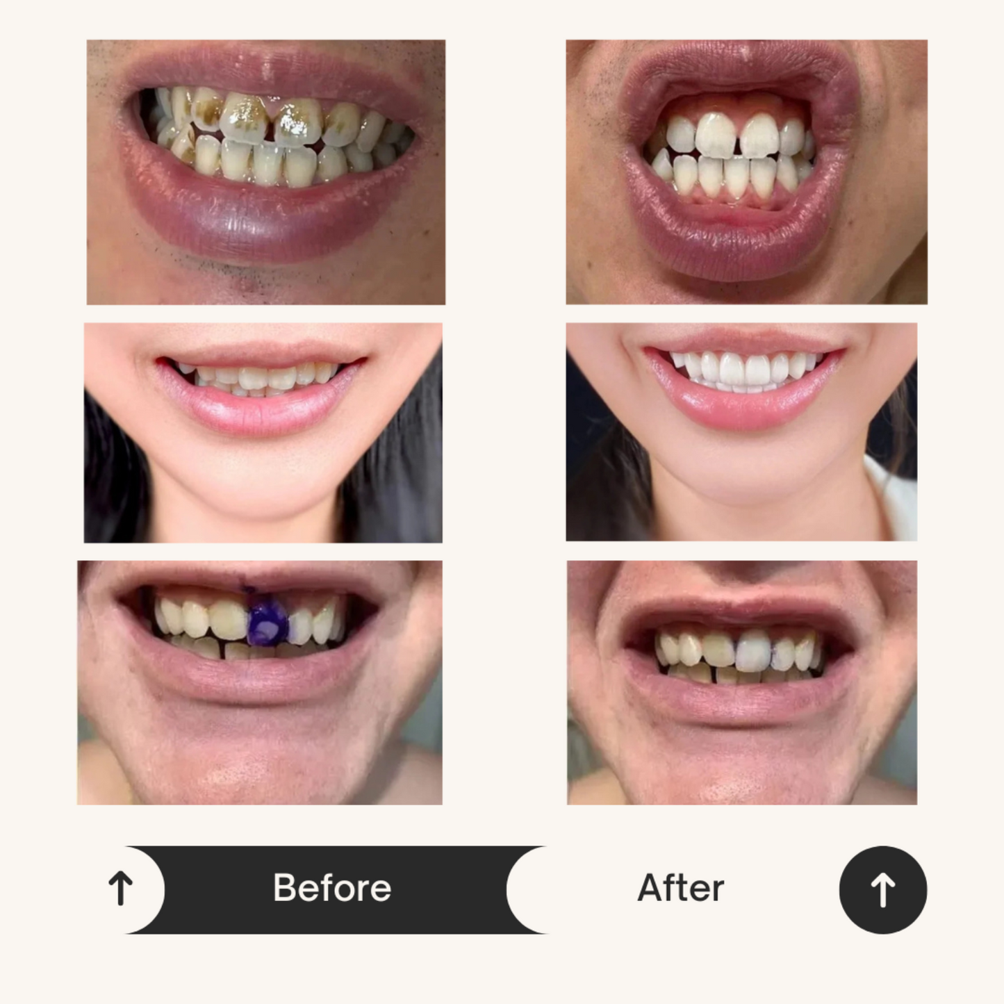 Instasmile™ - Dentifrice Violet Blanchissant